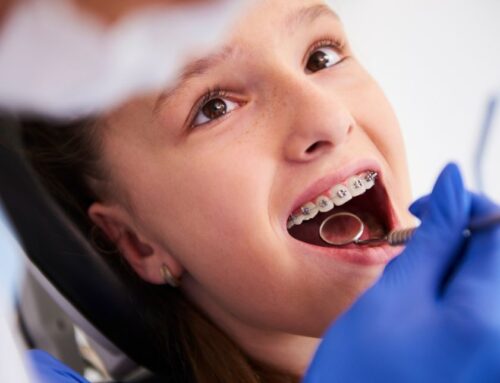 Why Early Orthodontic Treatment is Important