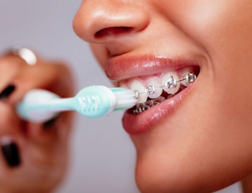 Tips for Maintaining Oral Hygiene While Undergoing Orthodontic Treatment