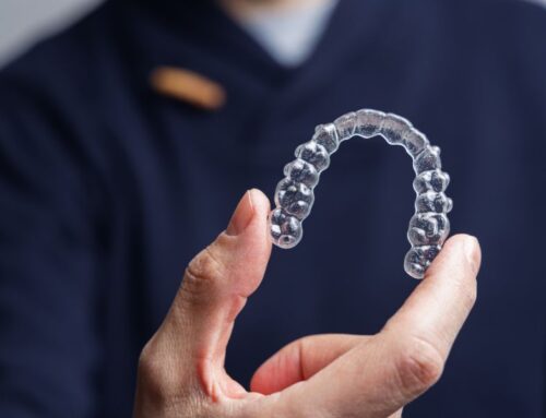 How To Choose Between Braces And Clear Aligners