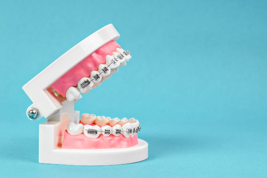 braces in reno image 2