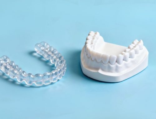 Behind Every Great Smile Is a Great Lab Tech